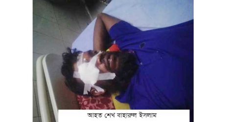 পাটকেলঘাটায় মৎস্য ঘেরকে কেন্দ্র করে প্রতিপক্ষের হামলায় আহত ১: থানায় অভিযোগ