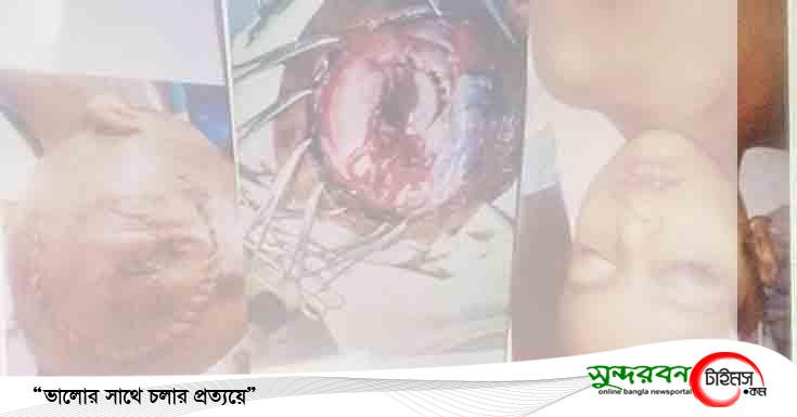 চুকনগরে সড়ক দূঘটনায় আহত পেপার বিক্রেতার ছেলের জন্য মানবিক সাহায্যের আবেদন