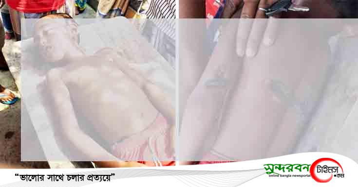 শ্যামনগরে খেলার সময় বিদ্যুতের তার ছিড়ে এক শিশুর মর্মান্তিক মৃত্যু