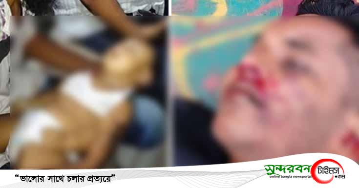 ডুমুরিয়ায় পৃথক দুর্ঘটনায় ৮ মাসের শিশুসহ নিহত- ২